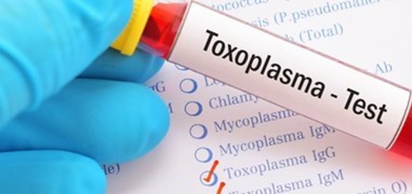  בדיקת נוגדני טוקסופלסמה (Toxoplasma IgG) - תמונה